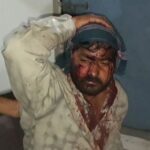 d 3 4 News Todayz धारदार हथियारों से युवक पर जान लेवा हमला,हालत गंभीर