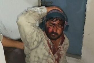 d 3 4 News Todayz धारदार हथियारों से युवक पर जान लेवा हमला,हालत गंभीर