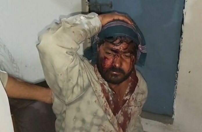 d 3 4 News Todayz धारदार हथियारों से युवक पर जान लेवा हमला,हालत गंभीर